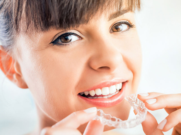 Top 3 Reasons You Want Invisalign Instead of Braces