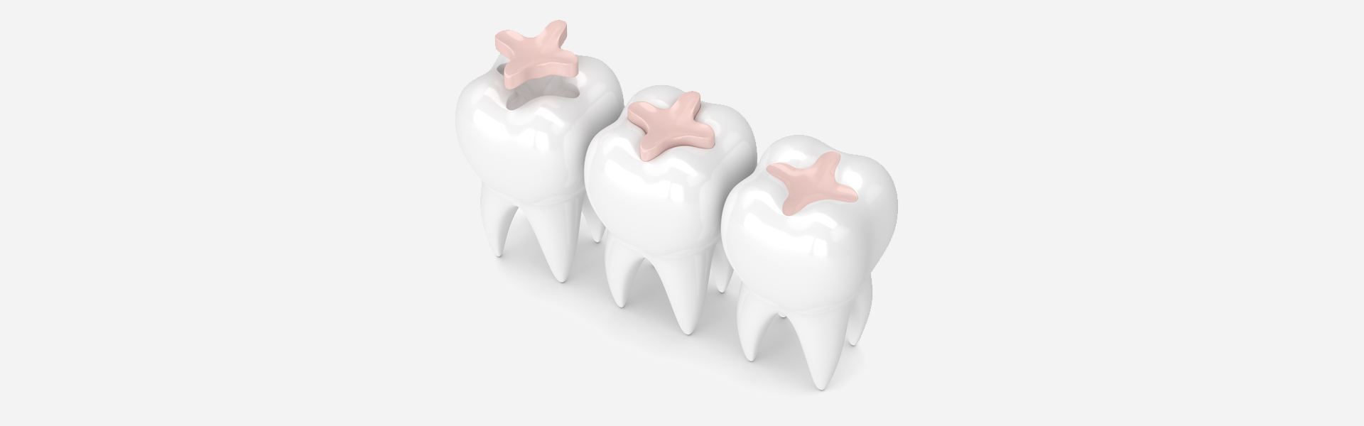 The Impact of Untreated Cavities on Overall Health: Why Dental Fillings Matter